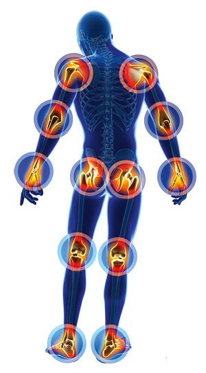 Gelenke am Körper, die von Polyarthritis betroffen sein können